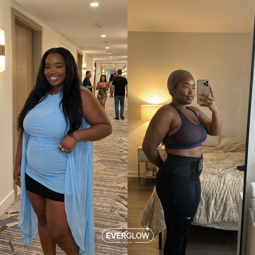 Brianna W. before and after weight loss transformation