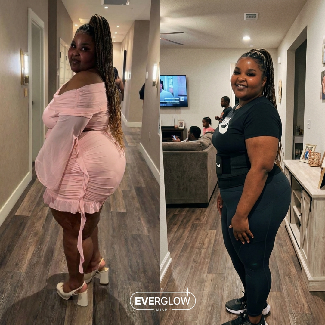 Tamara S. before and after weight loss transformation