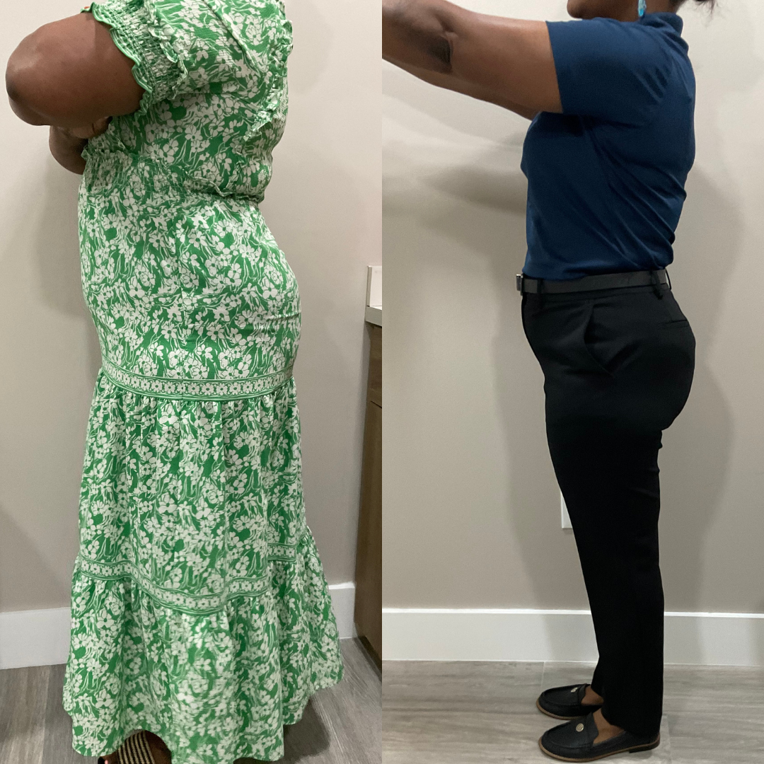Wynnefern O. before and after weight loss transformation